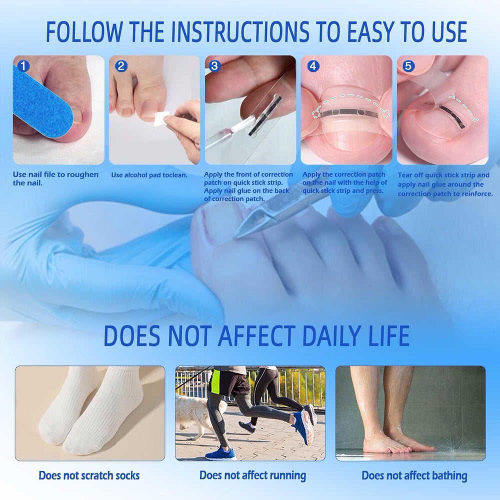 Truey reusable nail corrector offers long-lasting support and cost savings.