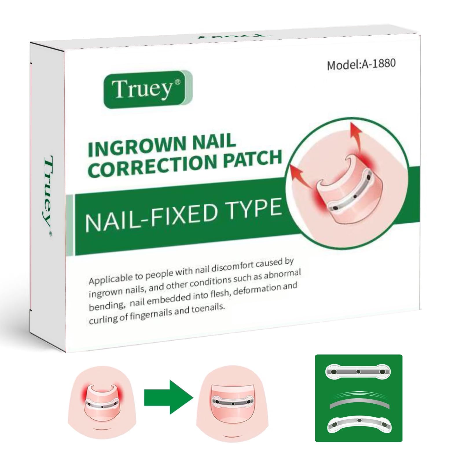 Truey titanium alloy silicone patch on nail provides upward correction support for ingrown nails.