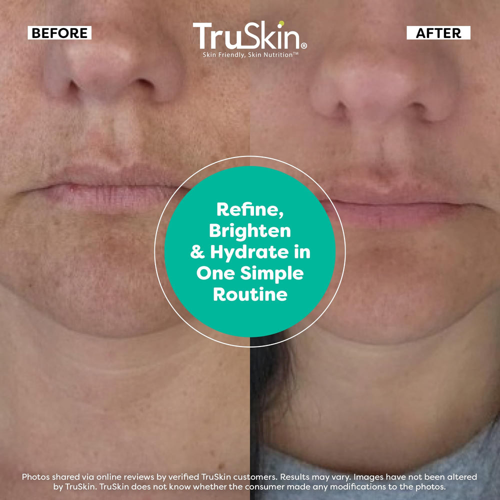 TruSkin Vitamin C serum bottle for even tone and a radiant glow.