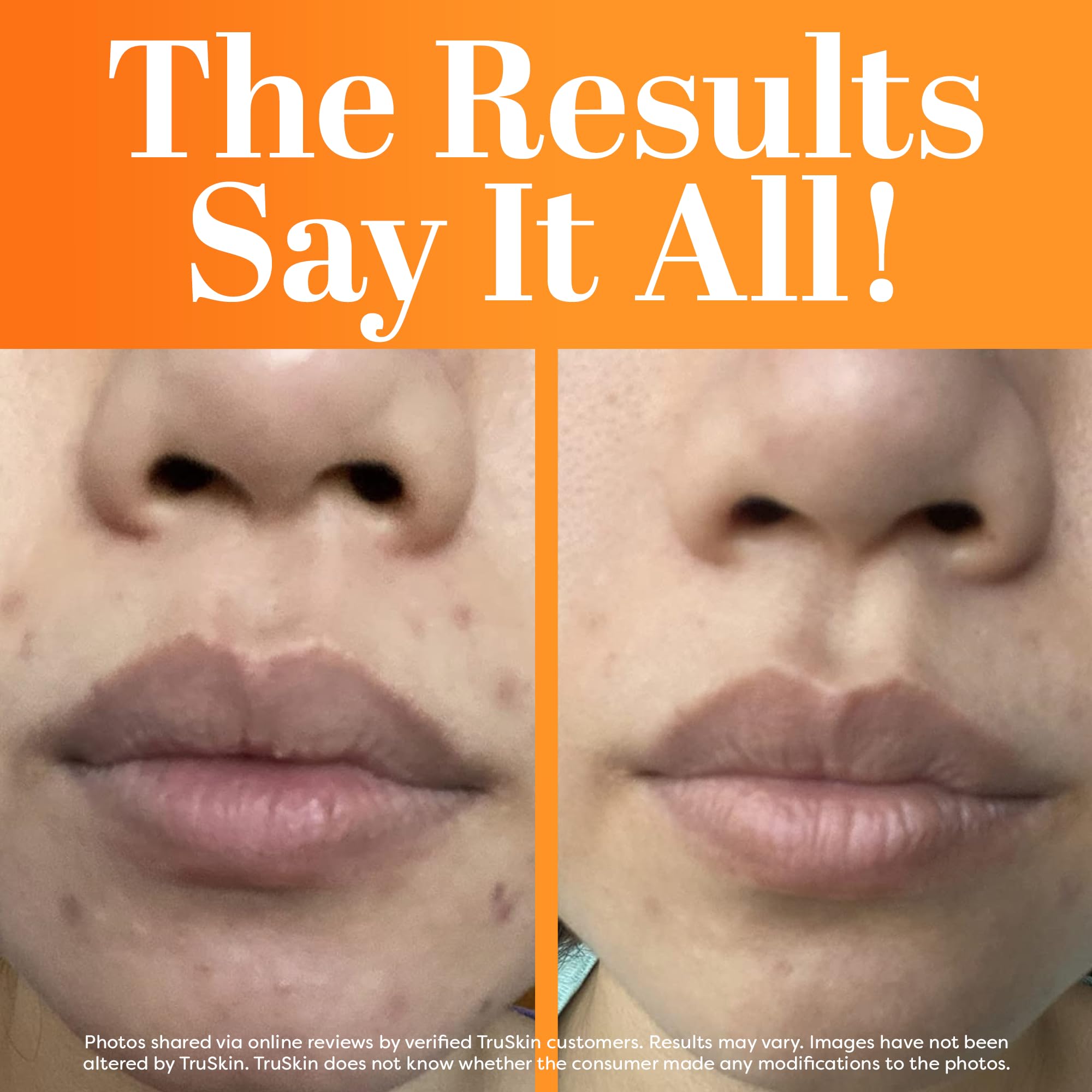 TruSkin Naturals Vitamin C Serum hand application demonstrates quick absorption and brightening prep.