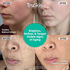 TruSkin Vitamin C serum drop close-up highlights precise morning dosing
