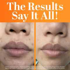 Close-up of TruSkin serum texture highlighting lightweight absorption
