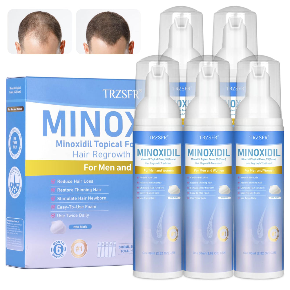 Trzsfr 5 percent minoxidil foam bottle close-up showing easy squeeze-foam application for hair regrowth