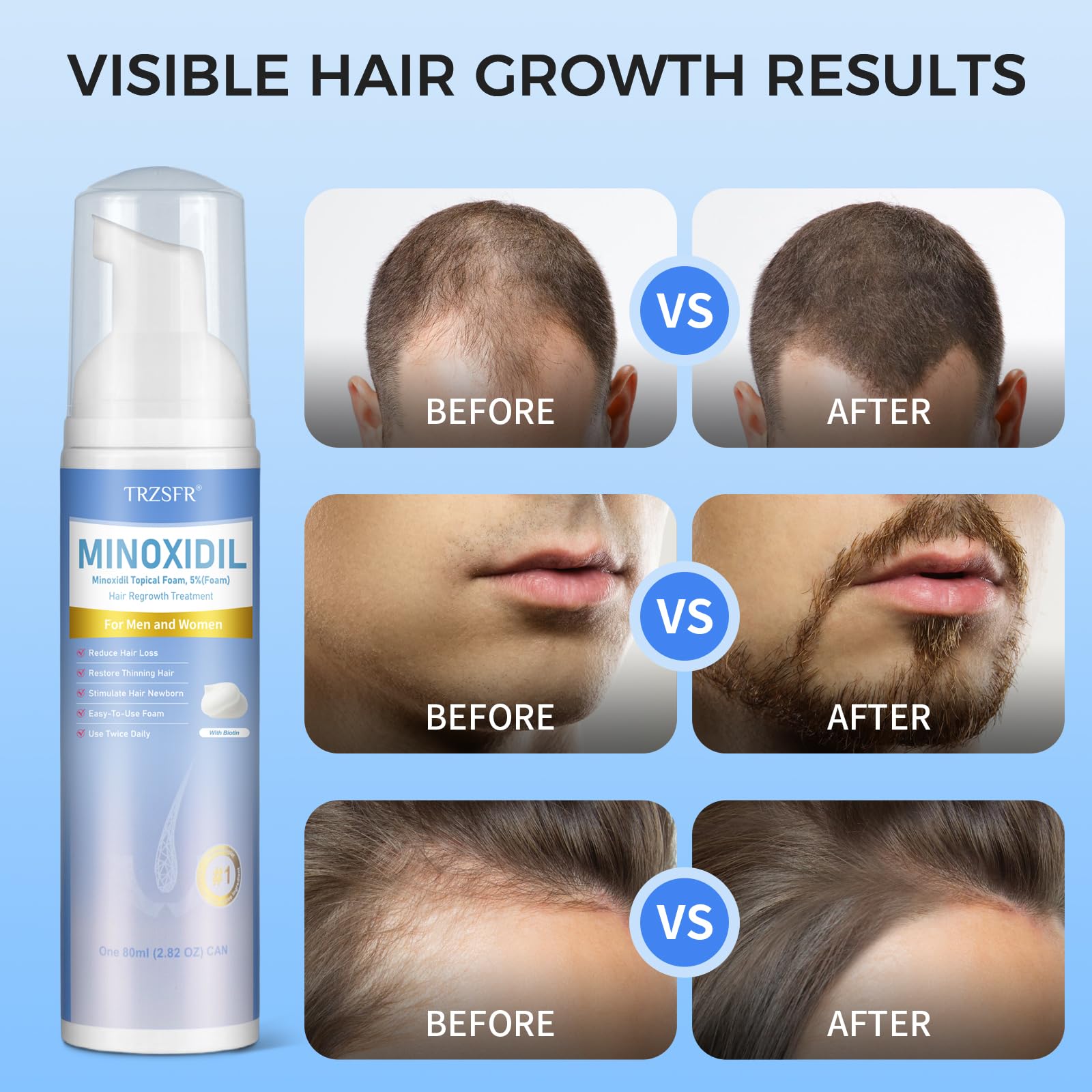 Trzsfr beard growth foam application for facial hair maintenance