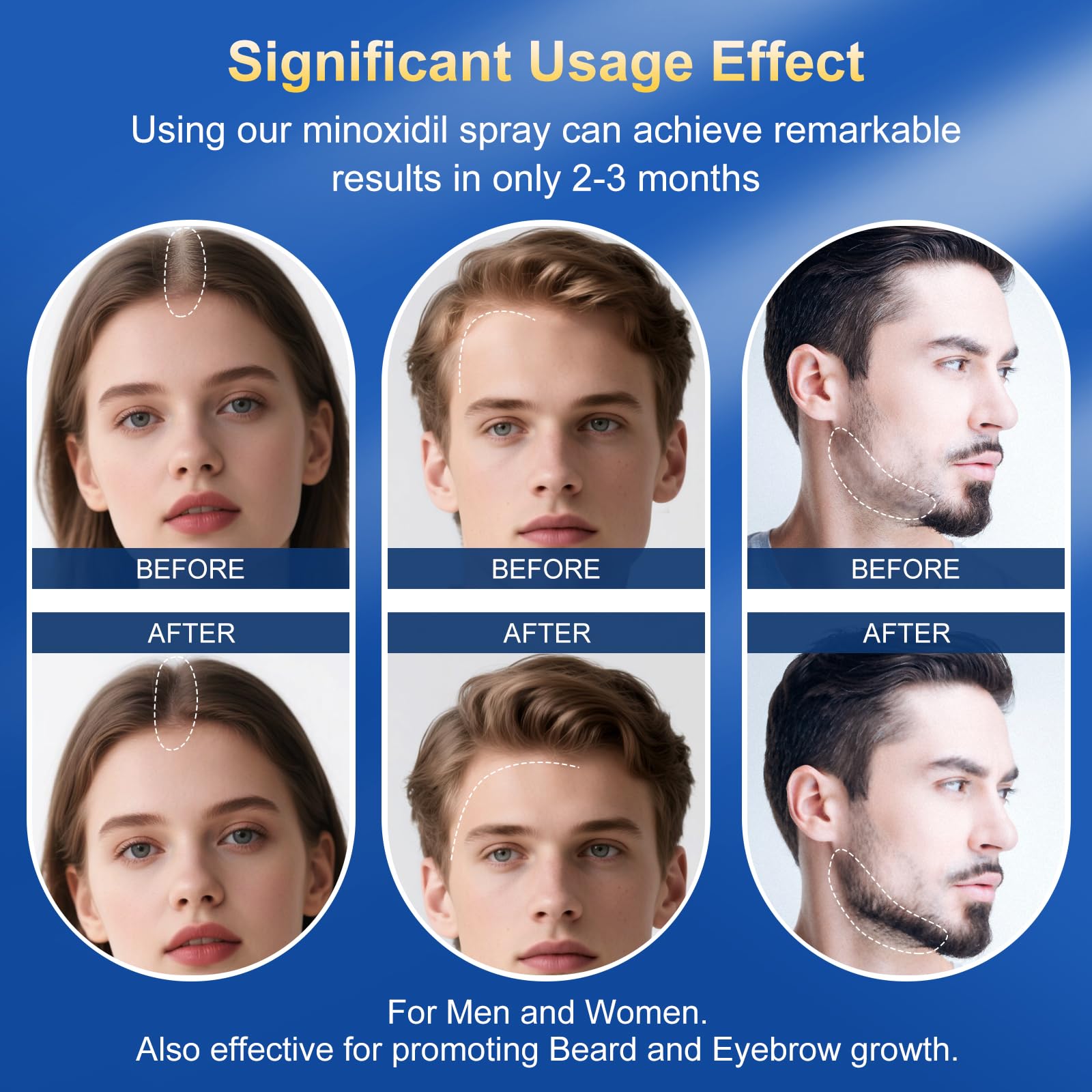 Trzsfr Propylene-glycol-free formula signifying gentler, non-irritating scalp care.
