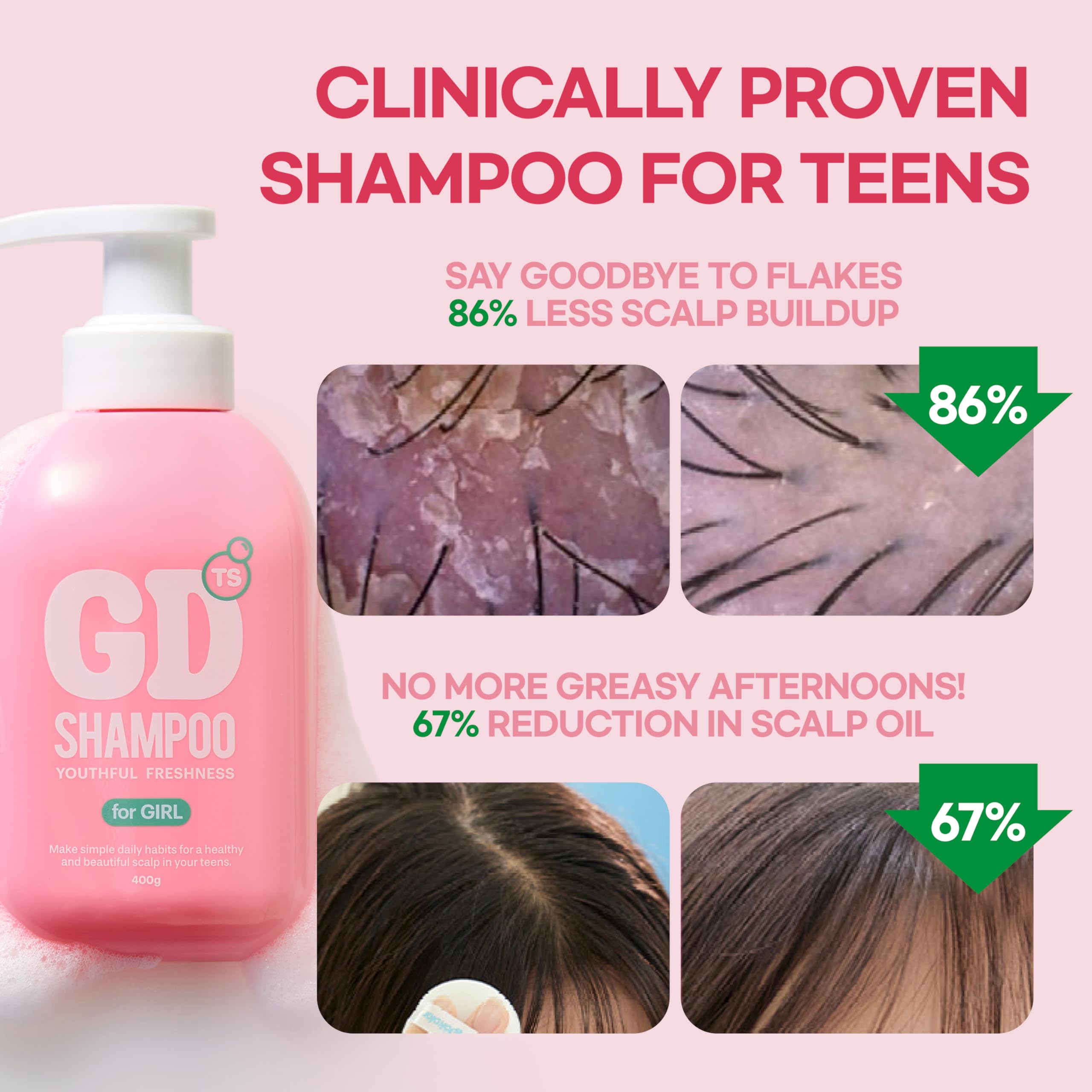 TS GD Shampoo fruity scent image conveys allergy-free fragrance for a pleasant daily wash.
