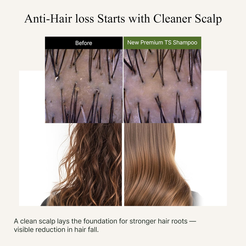 TS New Premium lather image highlights smooth cleansing for scalp comfort