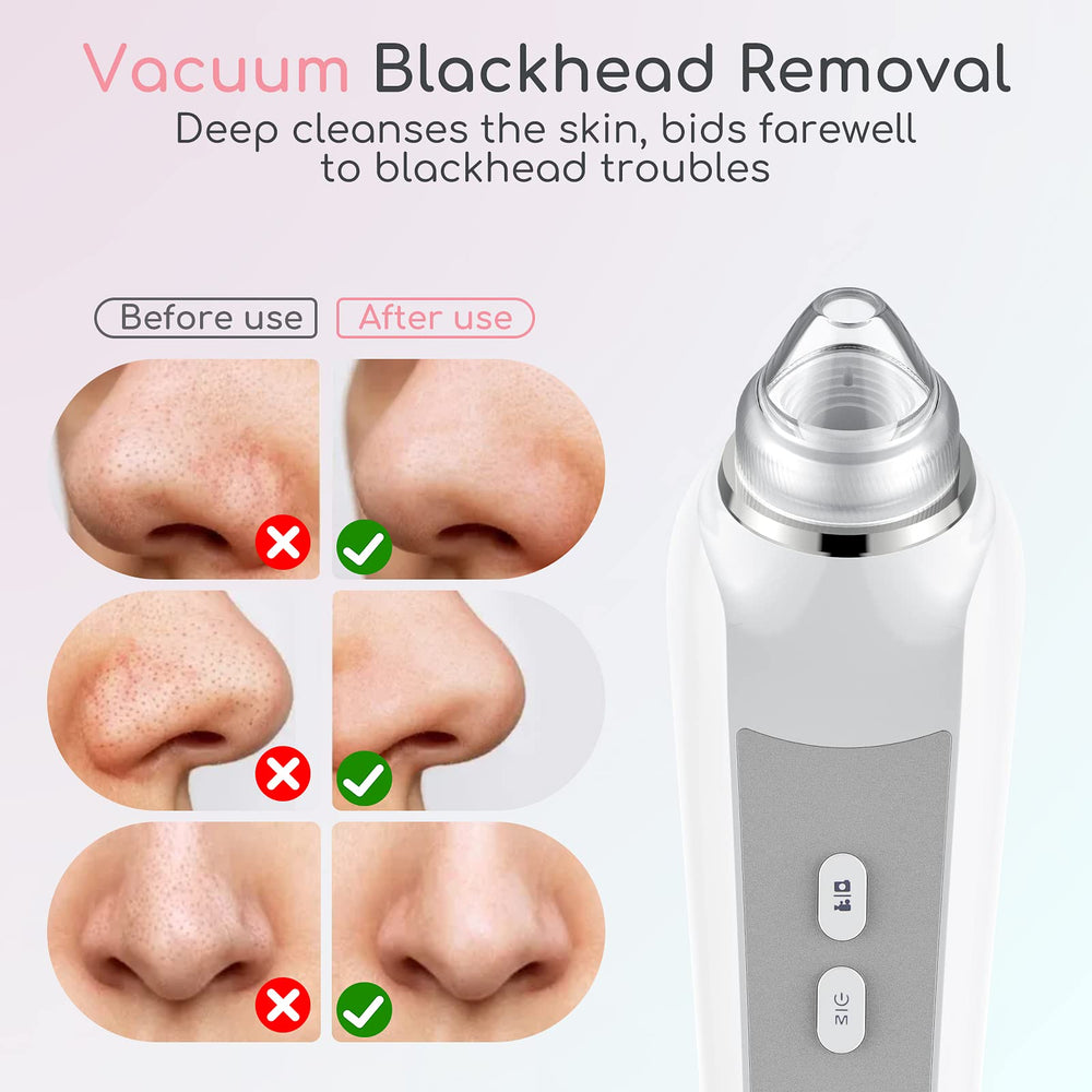 TTozka Blackhead Remover Vacuum app setup shows WiFi-guided routine.