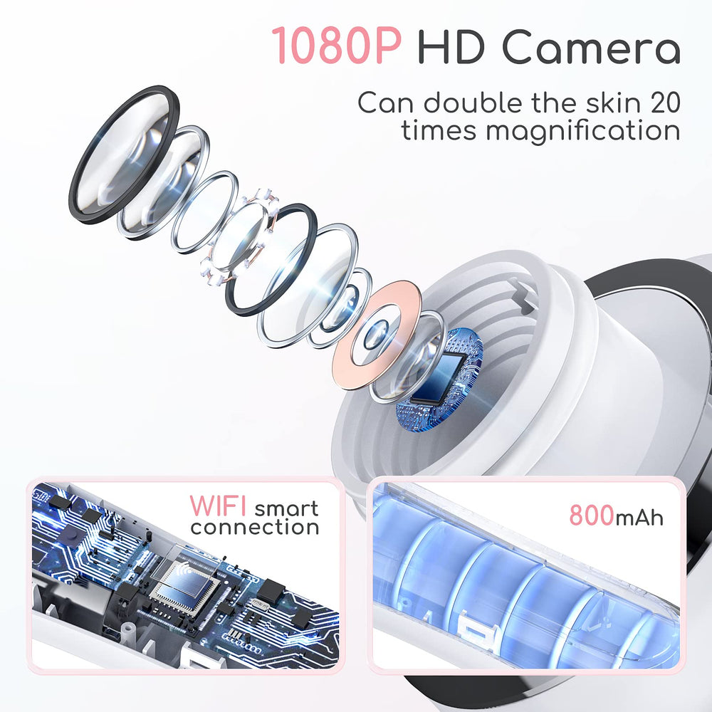 TTozka Blackhead Remover Vacuum camera view shows 20x magnification for precise treatment.