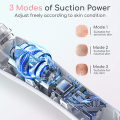 TTozka Blackhead Remover Vacuum LED light view ensures clear visibility during sessions.