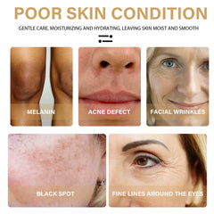 TTYRBF turmeric lemon oil ingredients highlight natural skin care benefits.