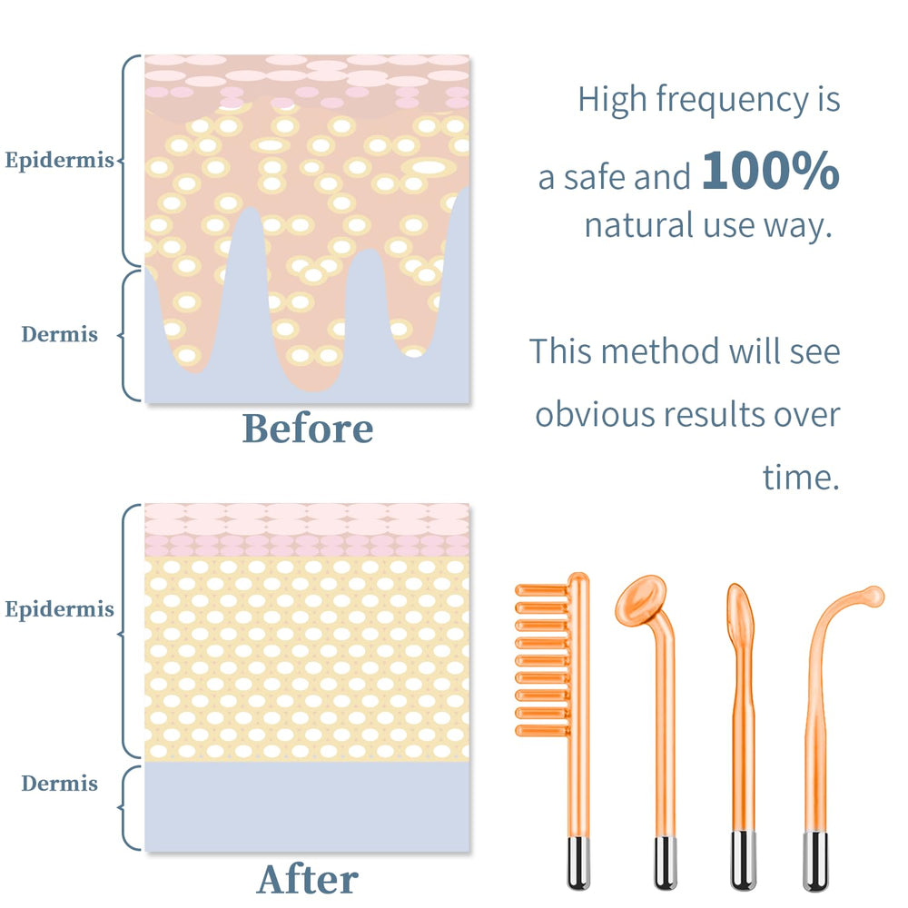 TUMAKOU high-frequency face machine in use during a skincare session
