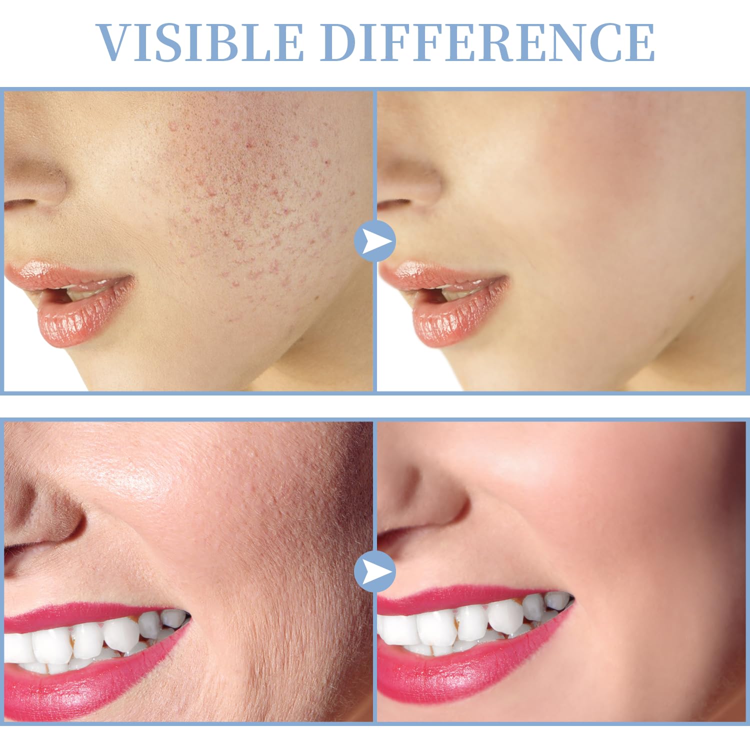 TUMAKOU mushroom attachment for broad surface treatment on cheeks and forehead