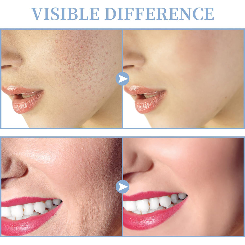 TUMAKOU mushroom attachment for broad surface treatment on cheeks and forehead
