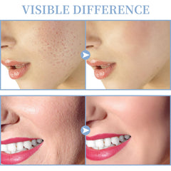 TUMAKOU mushroom attachment for broad surface treatment on cheeks and forehead