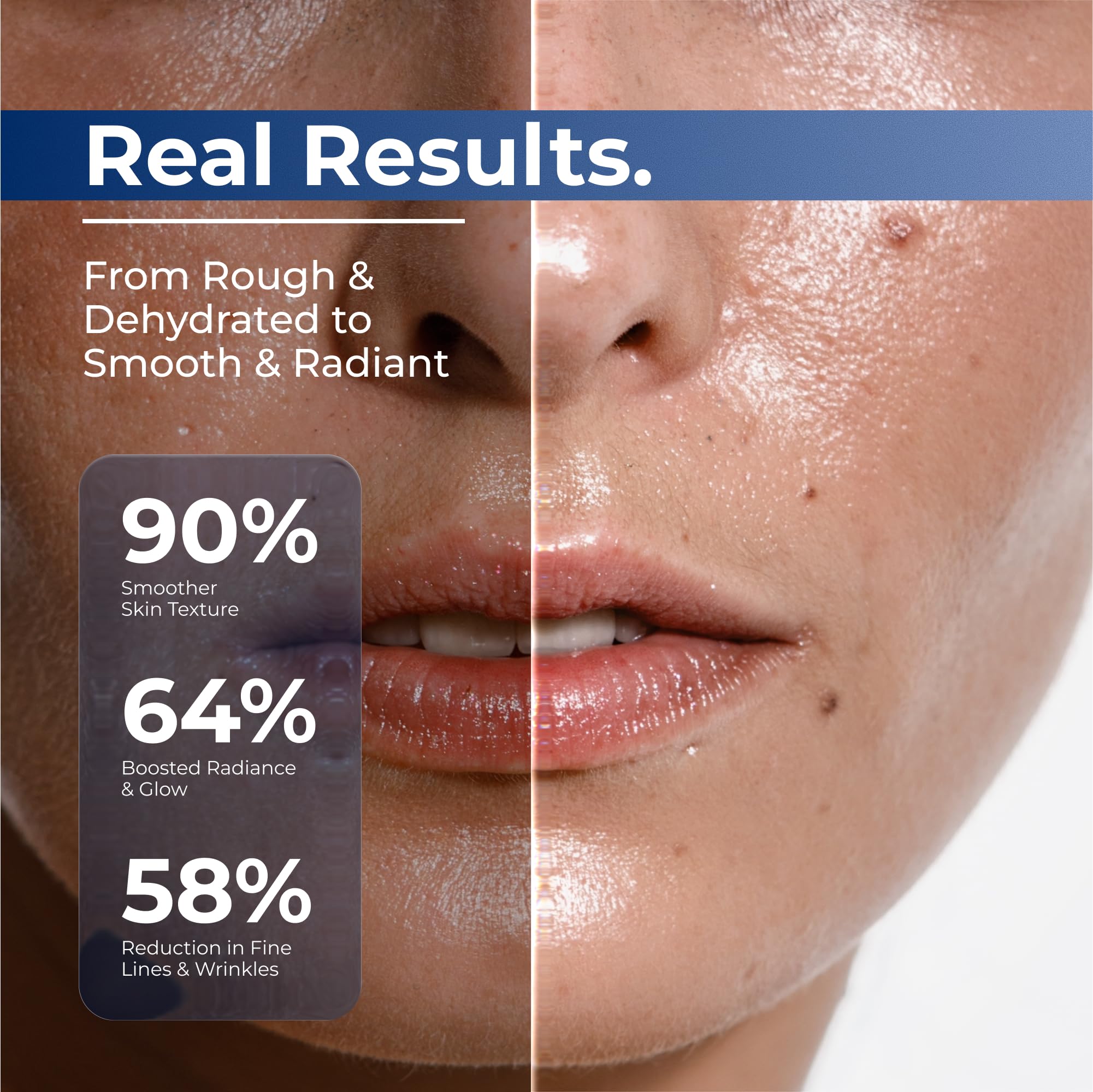 Turmskin Hyaluronic Serum Ampoules glass-skin look after use.