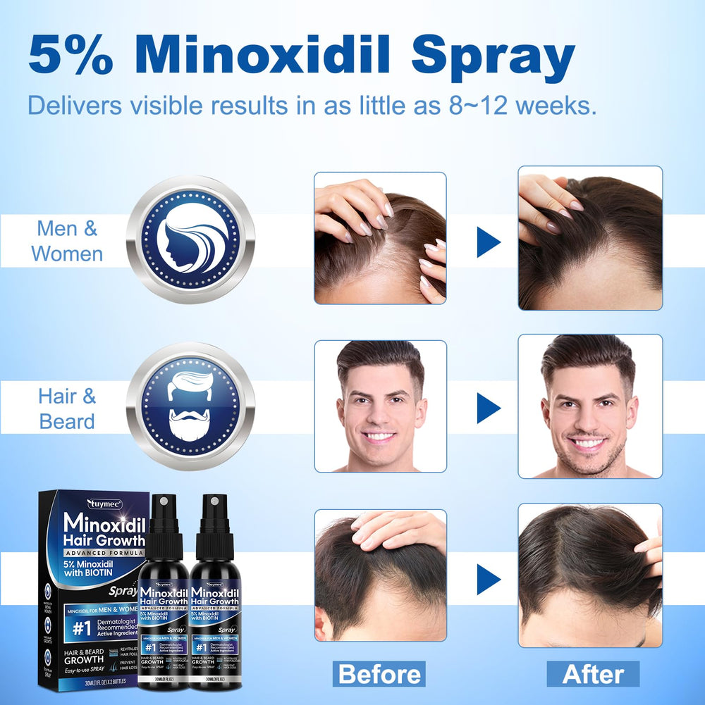 Tuymec Minoxidil beard-growth application illustrates multi-use capability