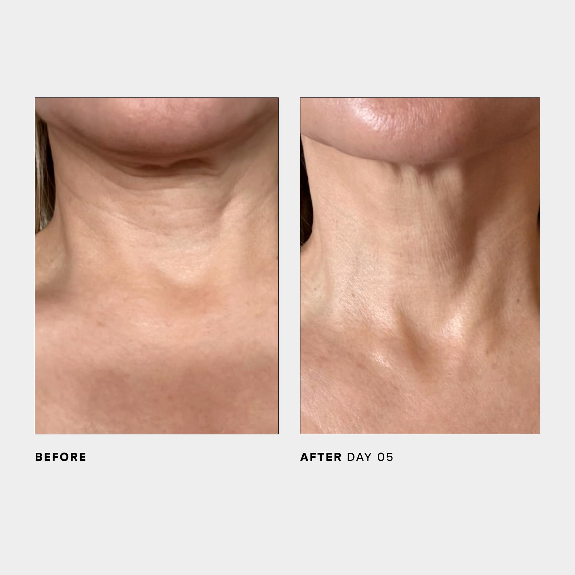 U Beauty SCULPT neck ingredients map emphasizes antioxidants and peptides.