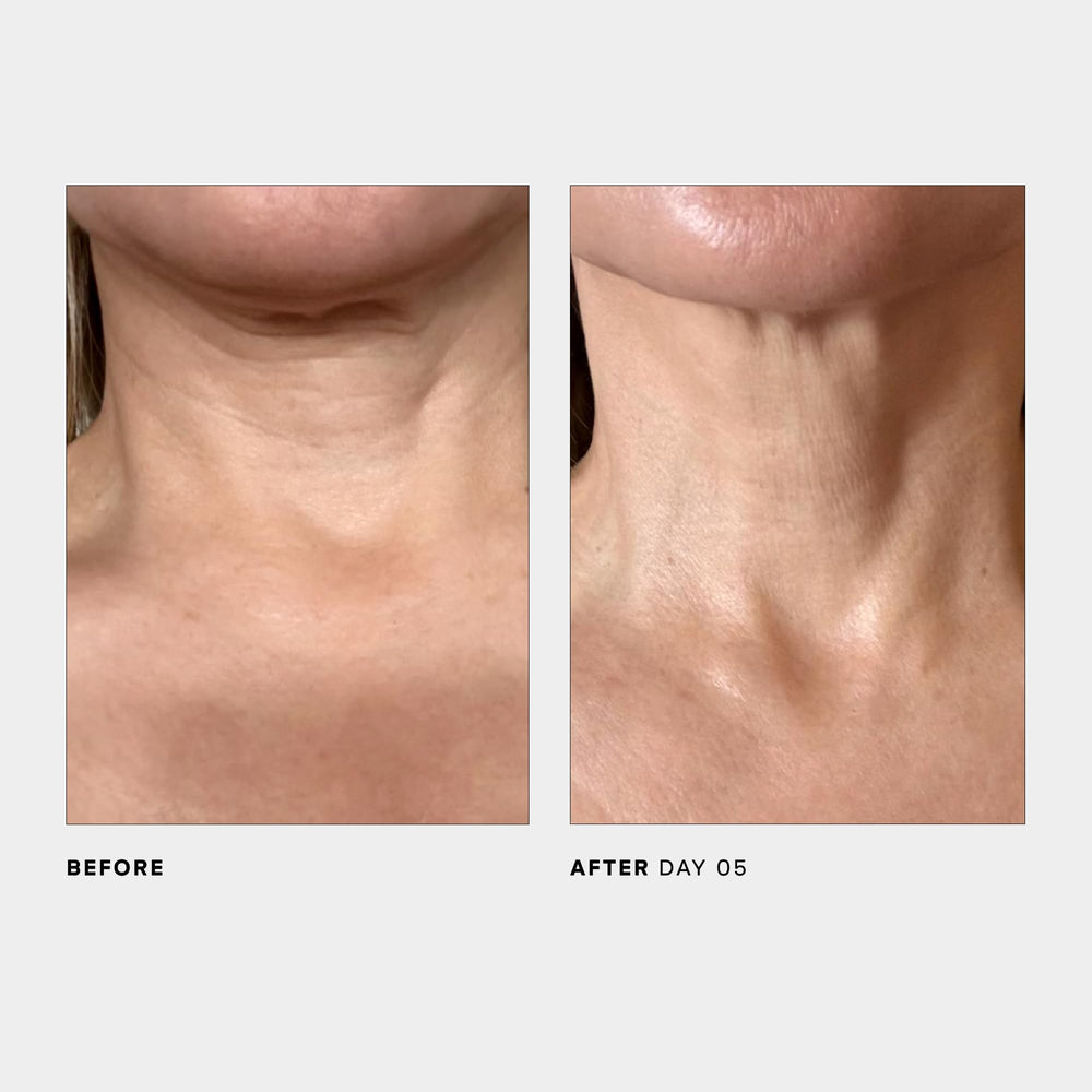 U Beauty SCULPT neck ingredients map emphasizes antioxidants and peptides.