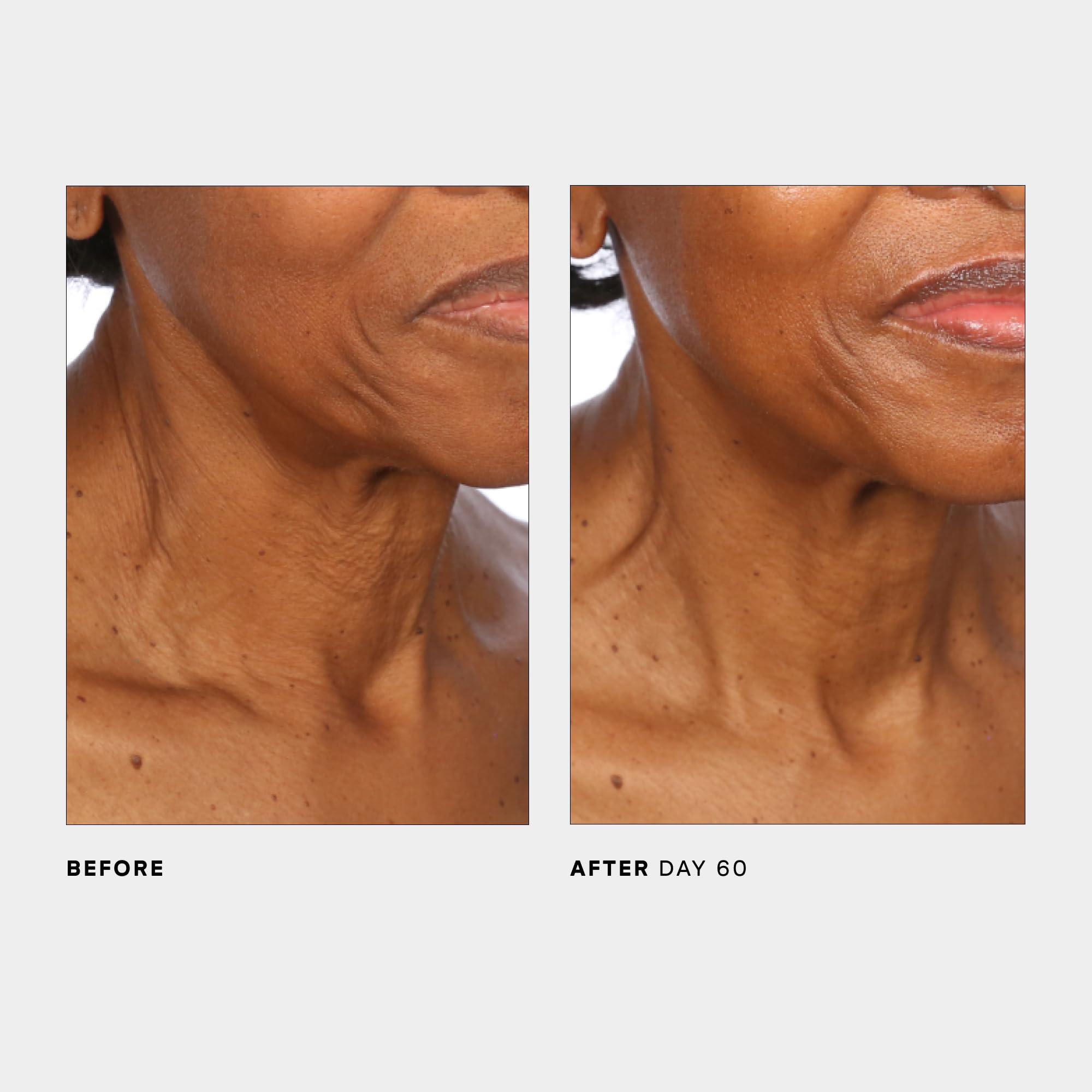 U Beauty SCULPT neck packaging display signals premium ritual.
