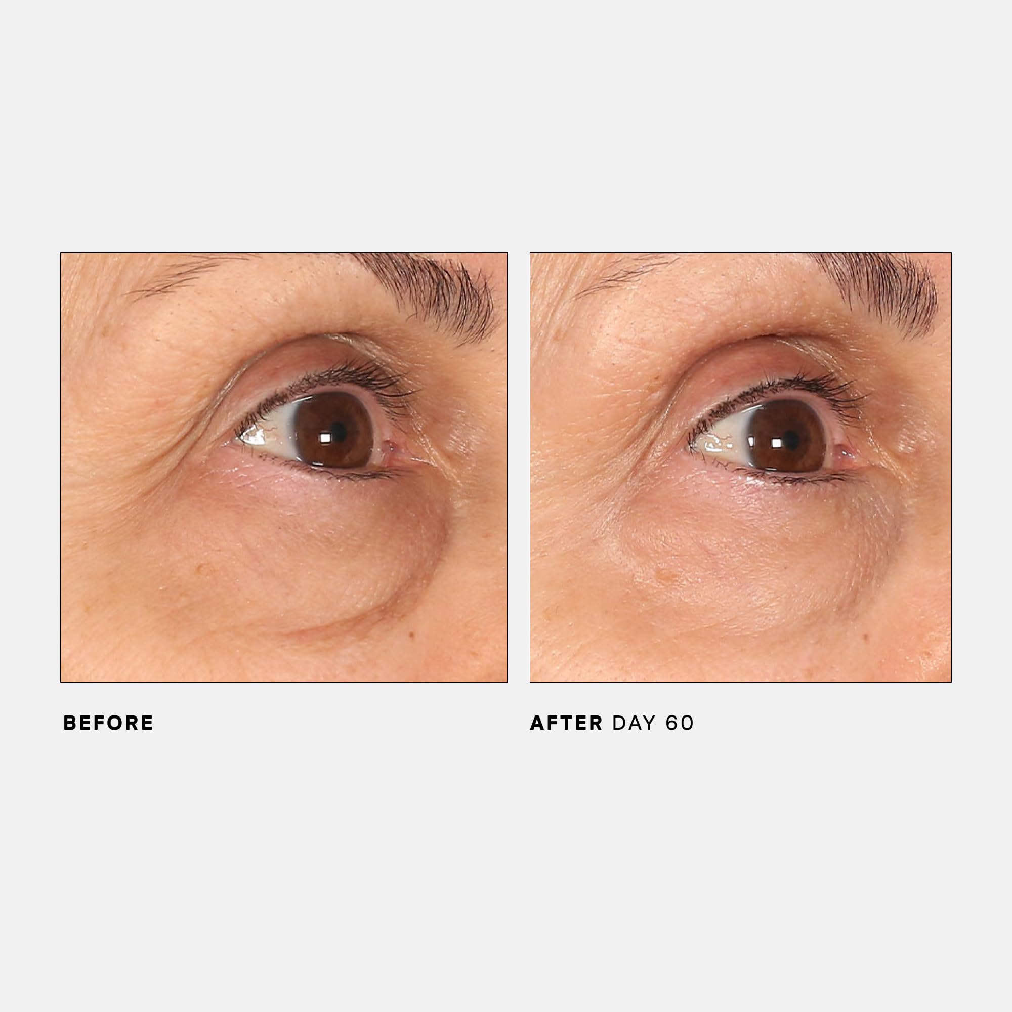 U Beauty The RETURN Eye Concentrate before-and-after depiction of brighter, tighter-looking under-eye area