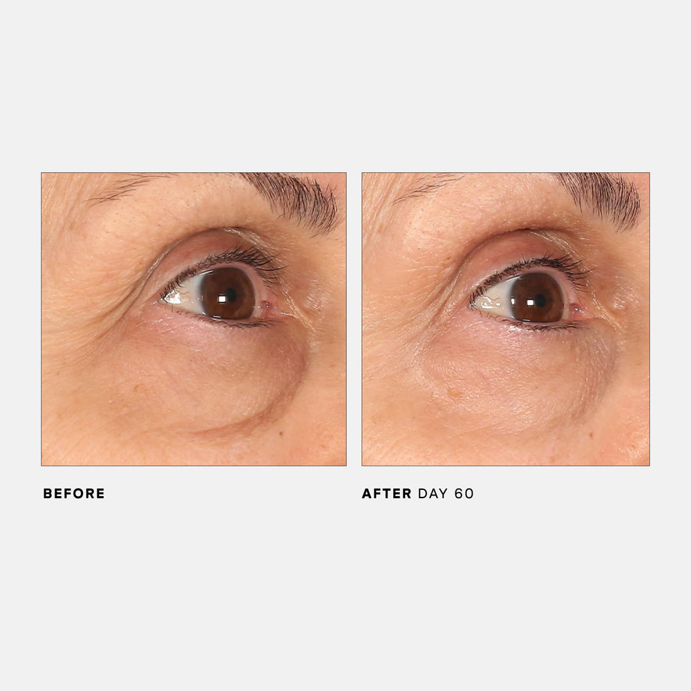 U Beauty The RETURN Eye Concentrate before-and-after depiction of brighter, tighter-looking under-eye area