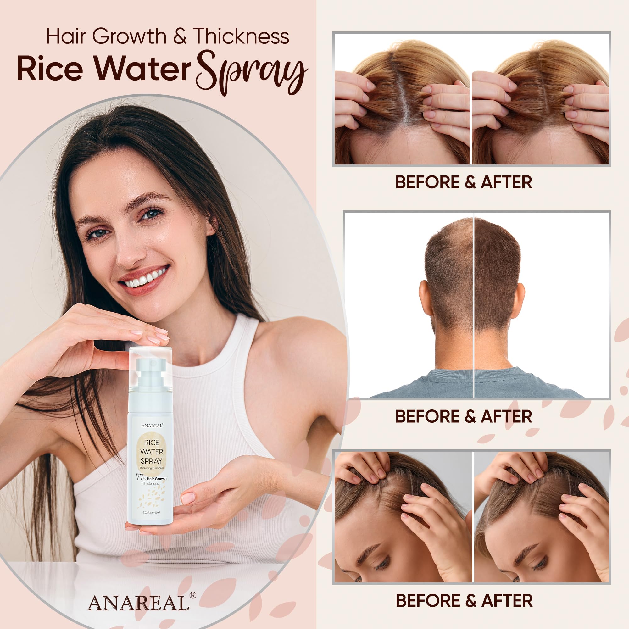 uikeaft Spray-on-scalp close-up supports nourishment and circulation.