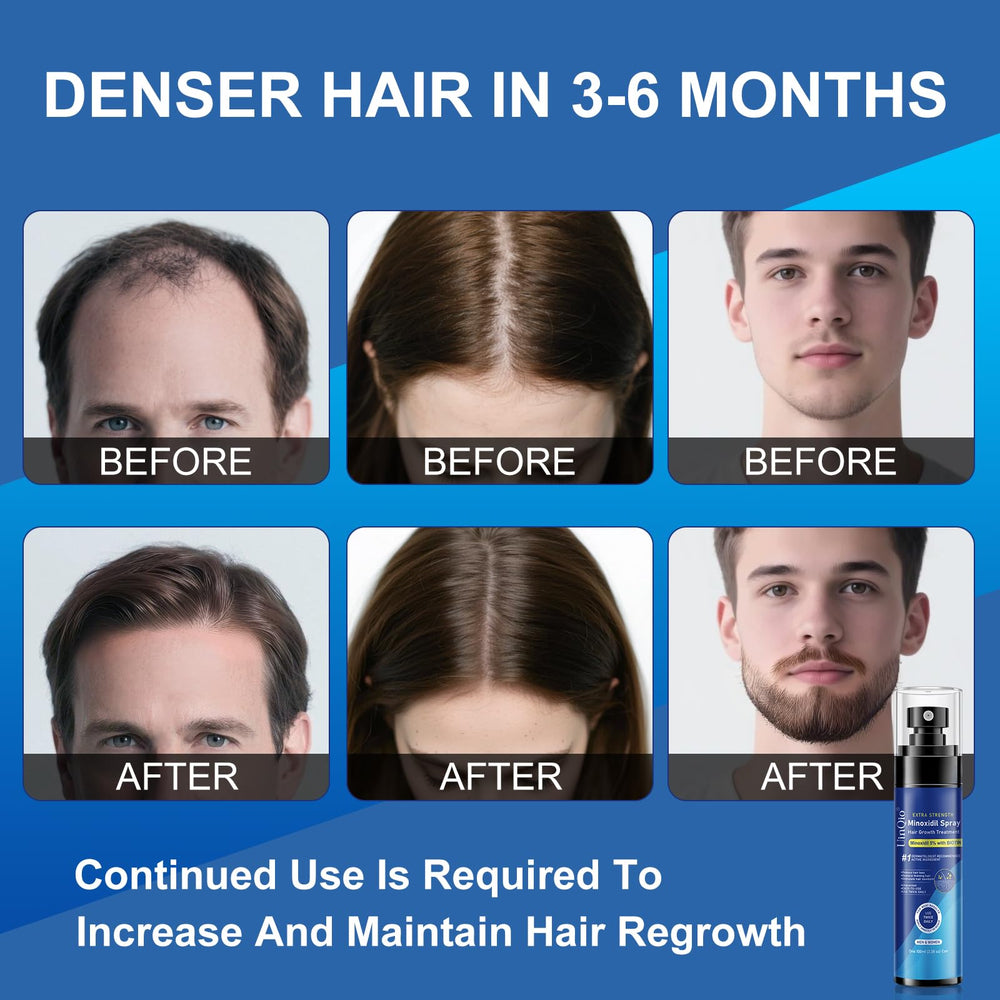 Uinqio Minoxidil Spray directions showing 3-4 pumps per application
