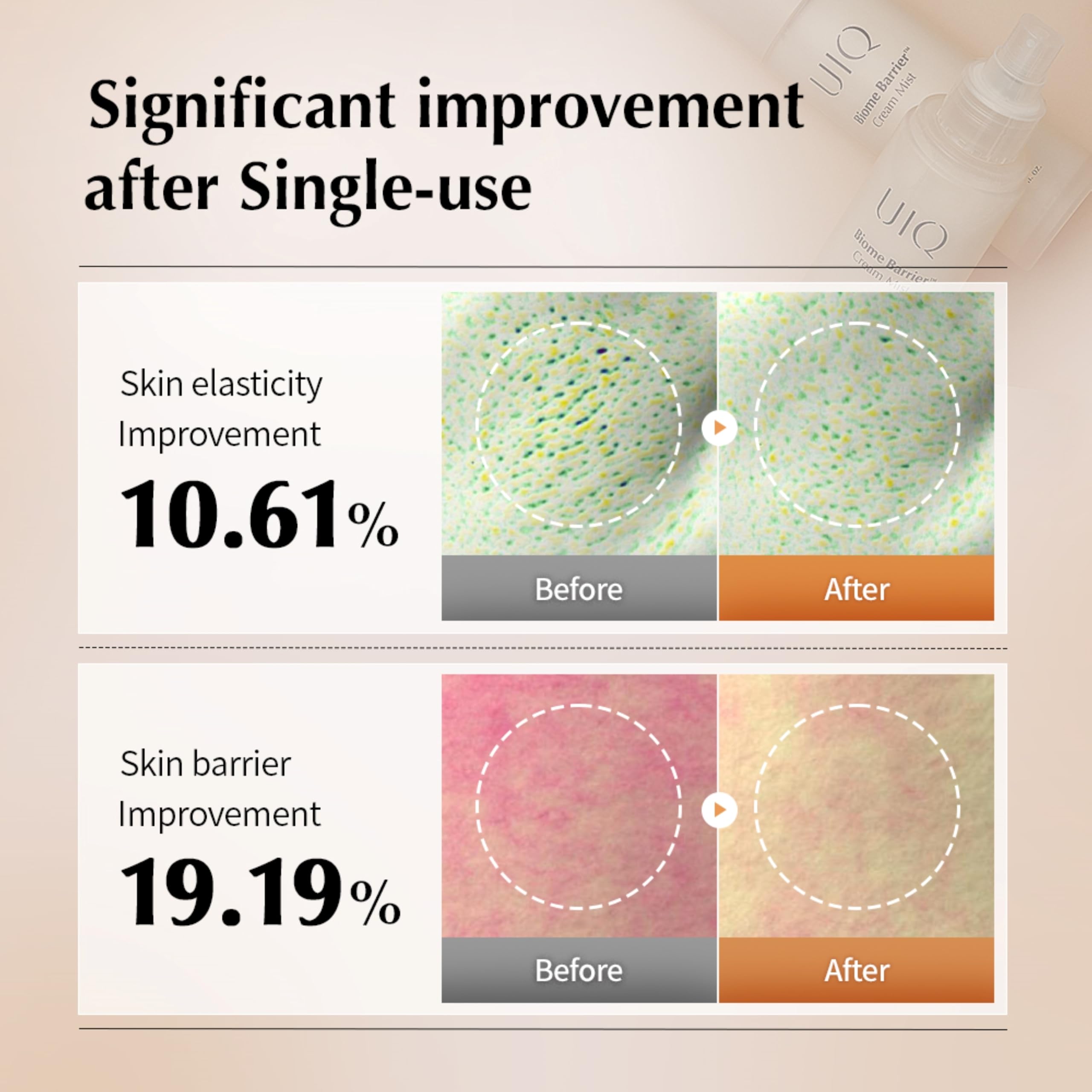 UIQ Biome Barrier Cream Mist Beta-glucan supports comforting skin texture.