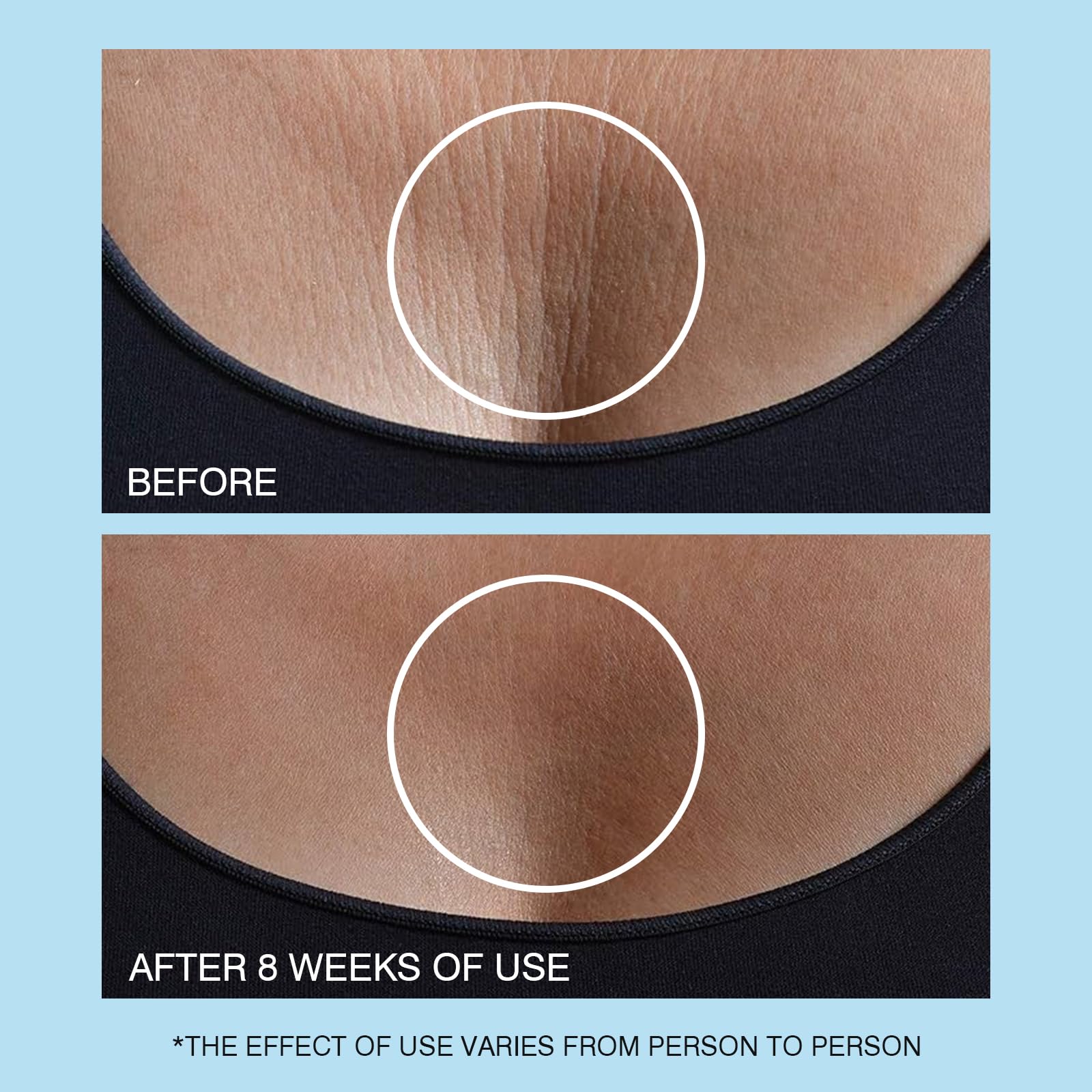 UJhay 3in1 neck-face-chest usage showing multitarget hydration and firming.