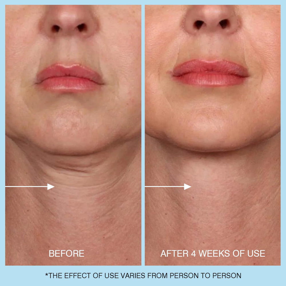 UJhay Retinol Neck Cream ingredients chart highlighting active components.