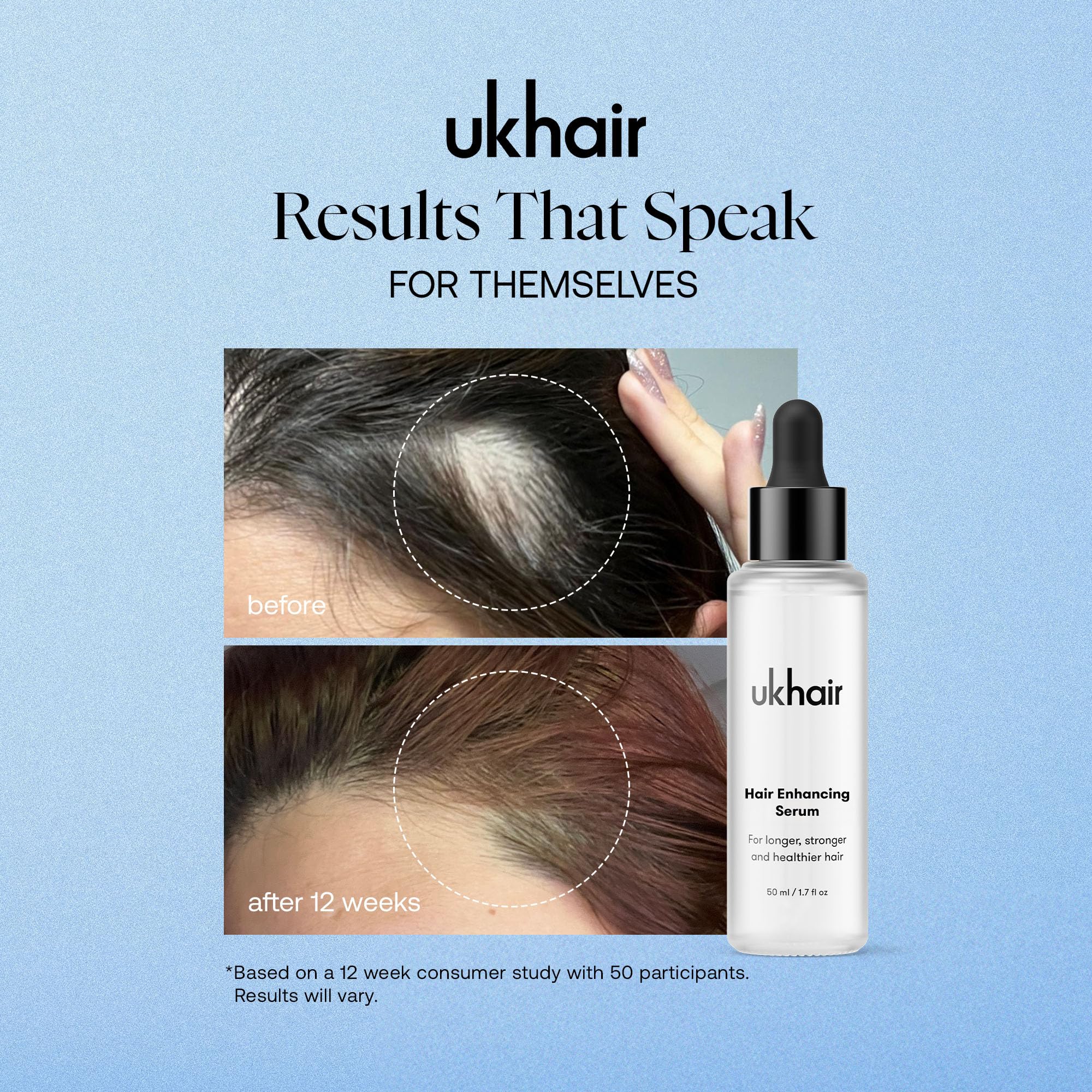 UKLASH applied to scalp with finger massage, illustrating targeted scalp benefit
