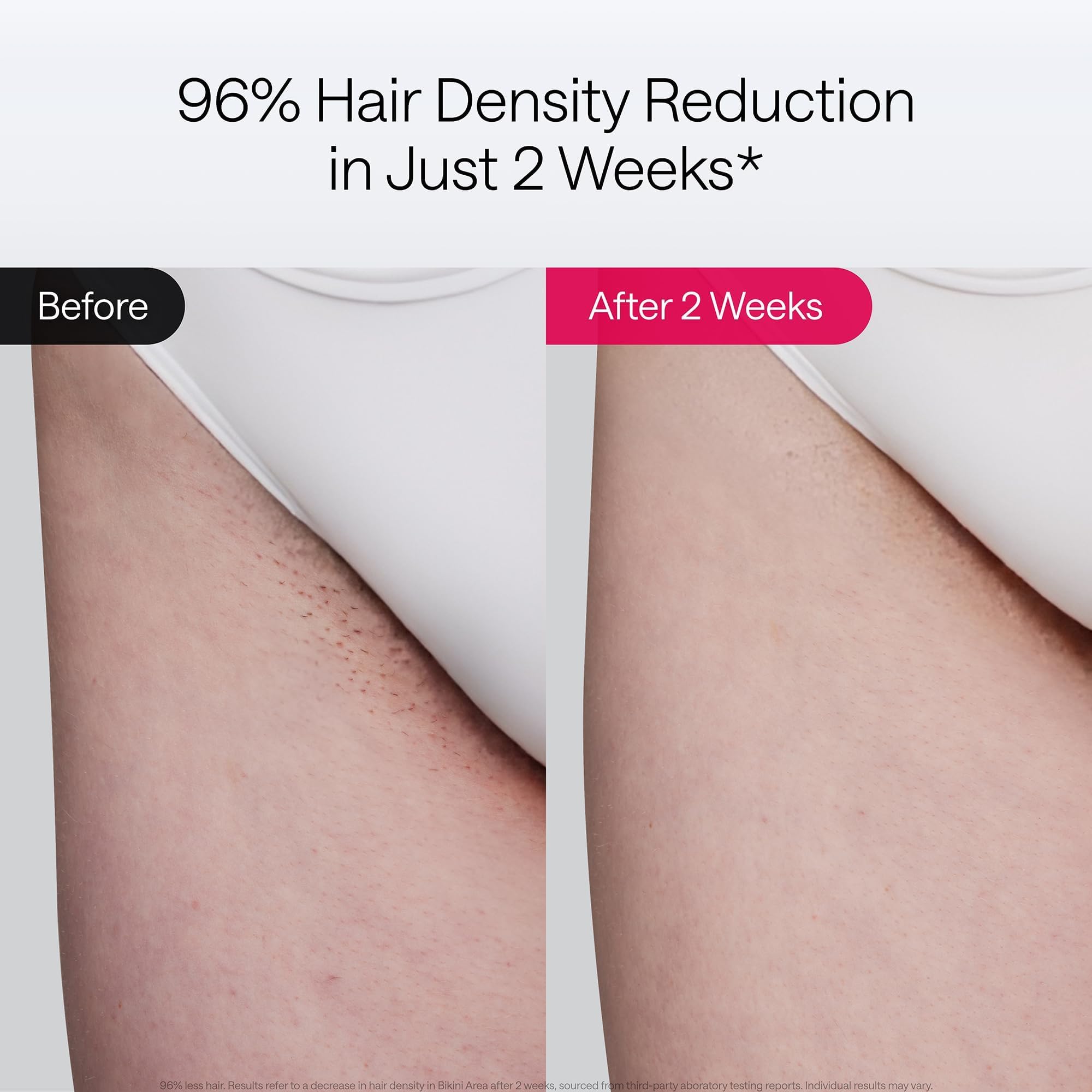 Ulike Air 10 IPL dual-light system image illustrating faster full-body treatment in minutes.