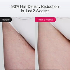 Ulike Air 10 IPL dual-light system image illustrating faster full-body treatment in minutes.