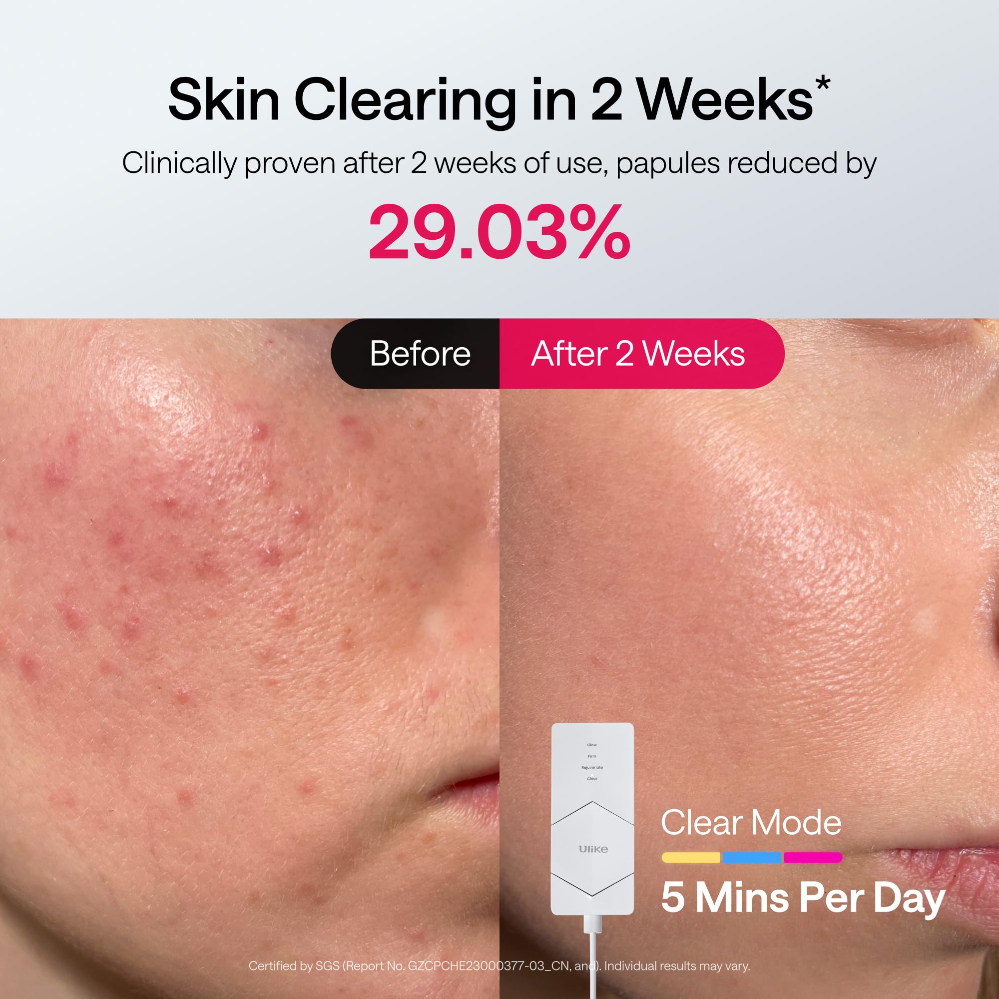 Ulike ReGlow-four-modes-glow-firm-rejuvenate-clear offers targeted skin benefits.