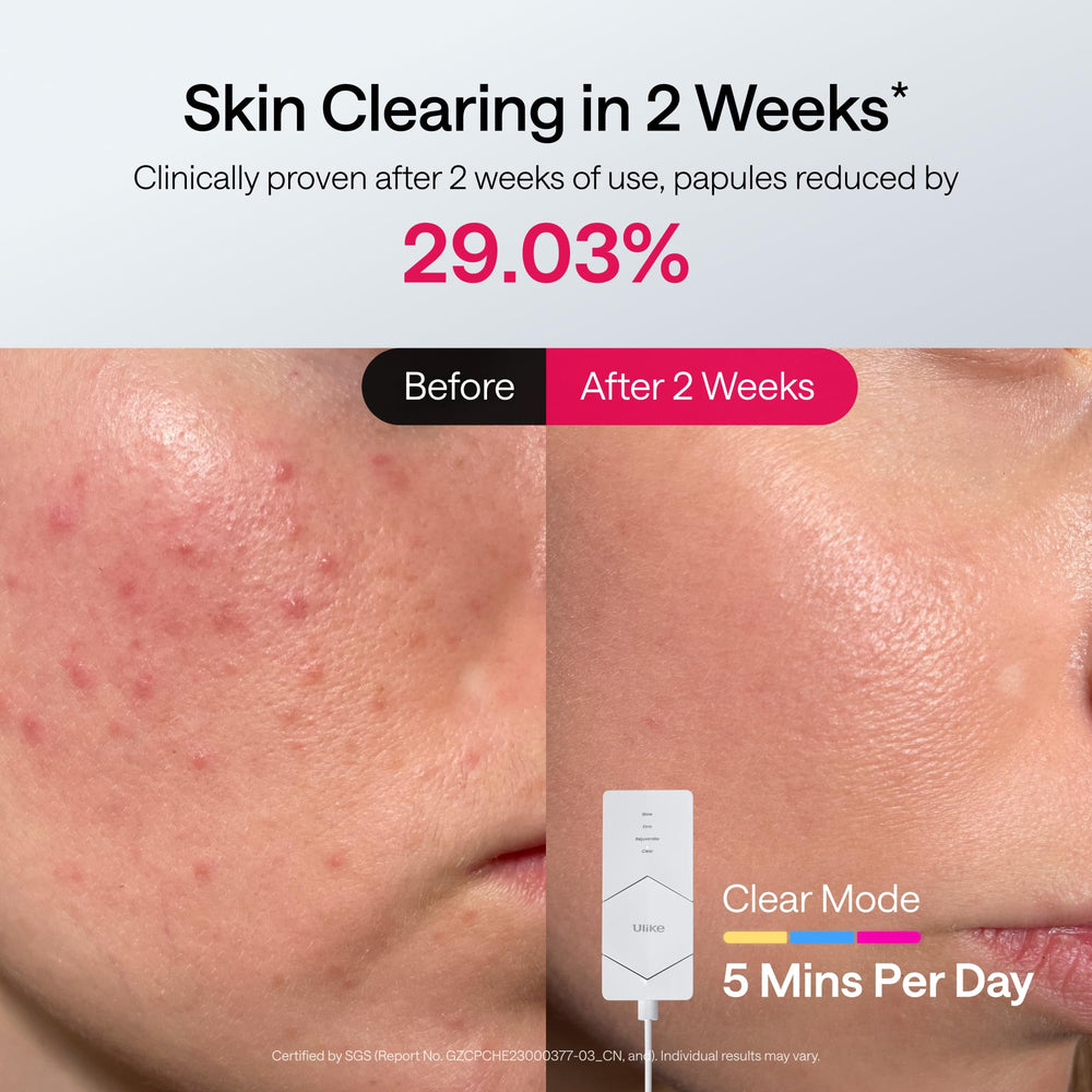 Ulike ReGlow-four-modes-glow-firm-rejuvenate-clear offers targeted skin benefits.