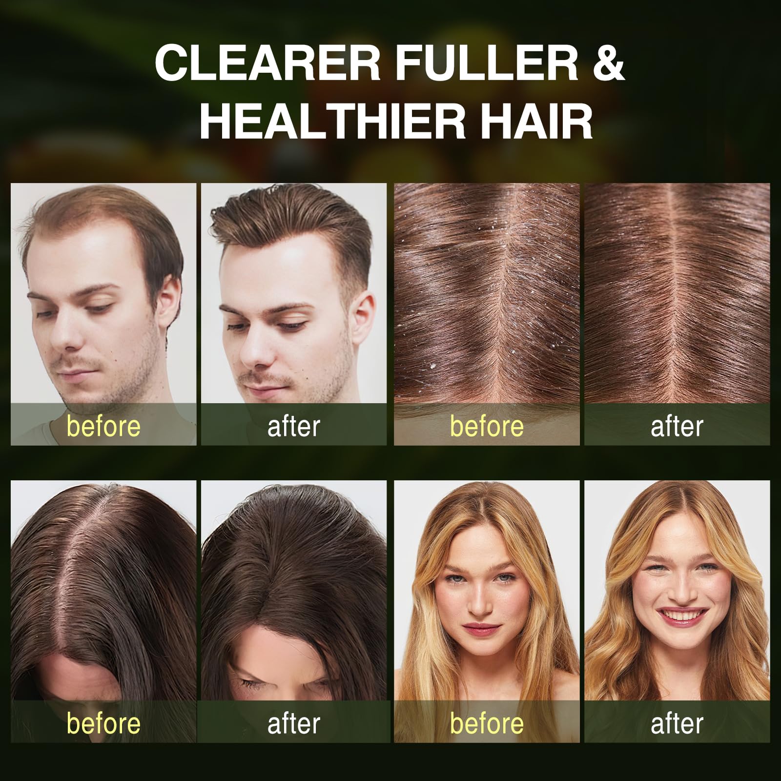 ulluxe Batana Oil Hair Growth Shampoo ingredients label highlights rosemary and mint