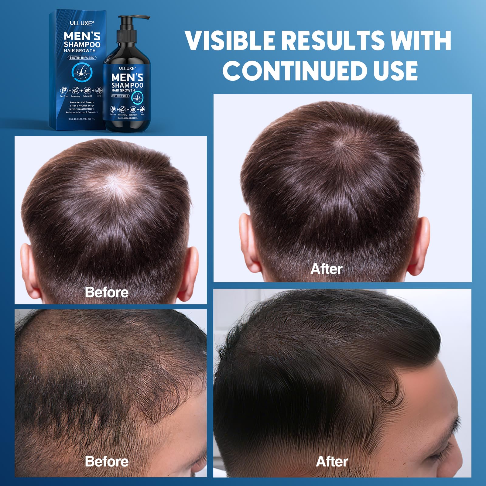 Ulluxe Biotin Hair Growth Shampoo sulfate-free label emphasizes gentle cleansing for sensitive skin