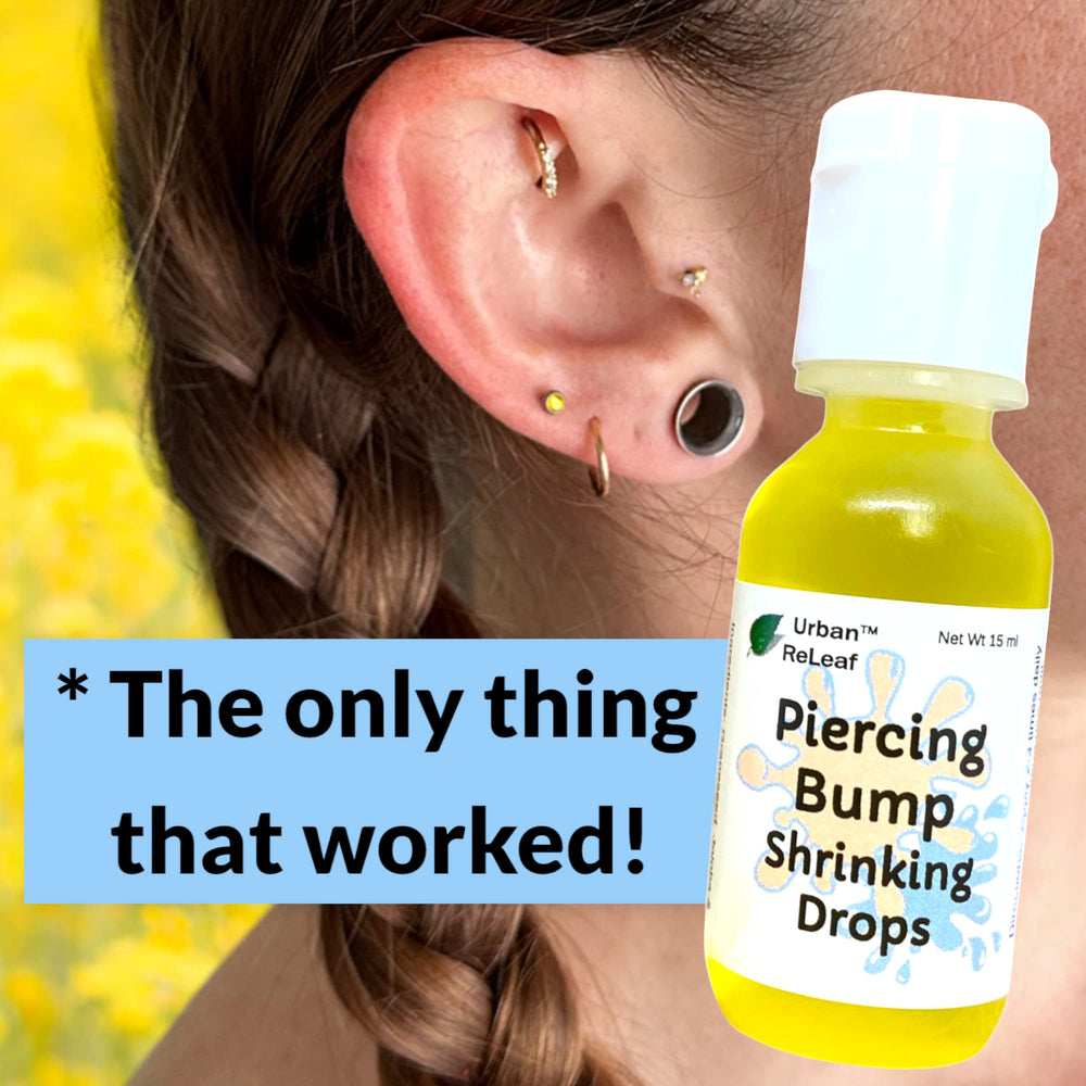 Urban ReLeaf piercing drops bump close-up shows targeted care.