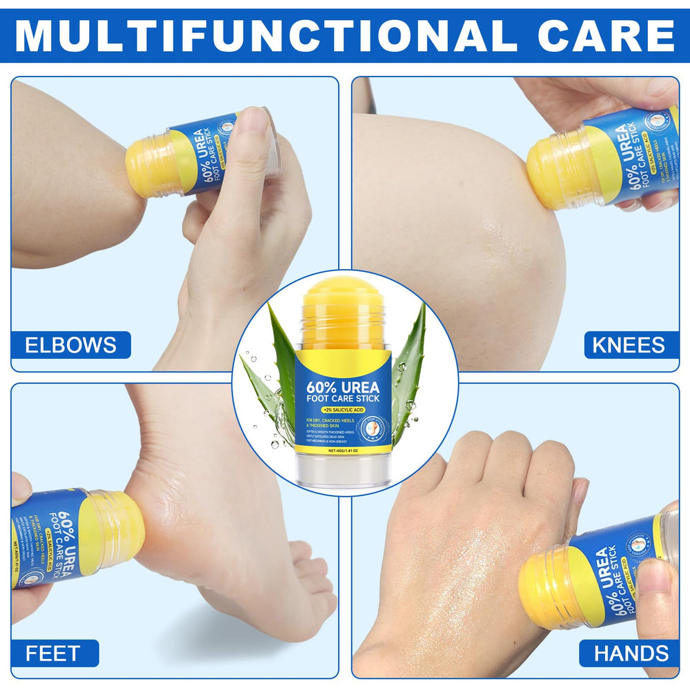 Urea foot cream before-after image illustrating smoother, hydrated feet