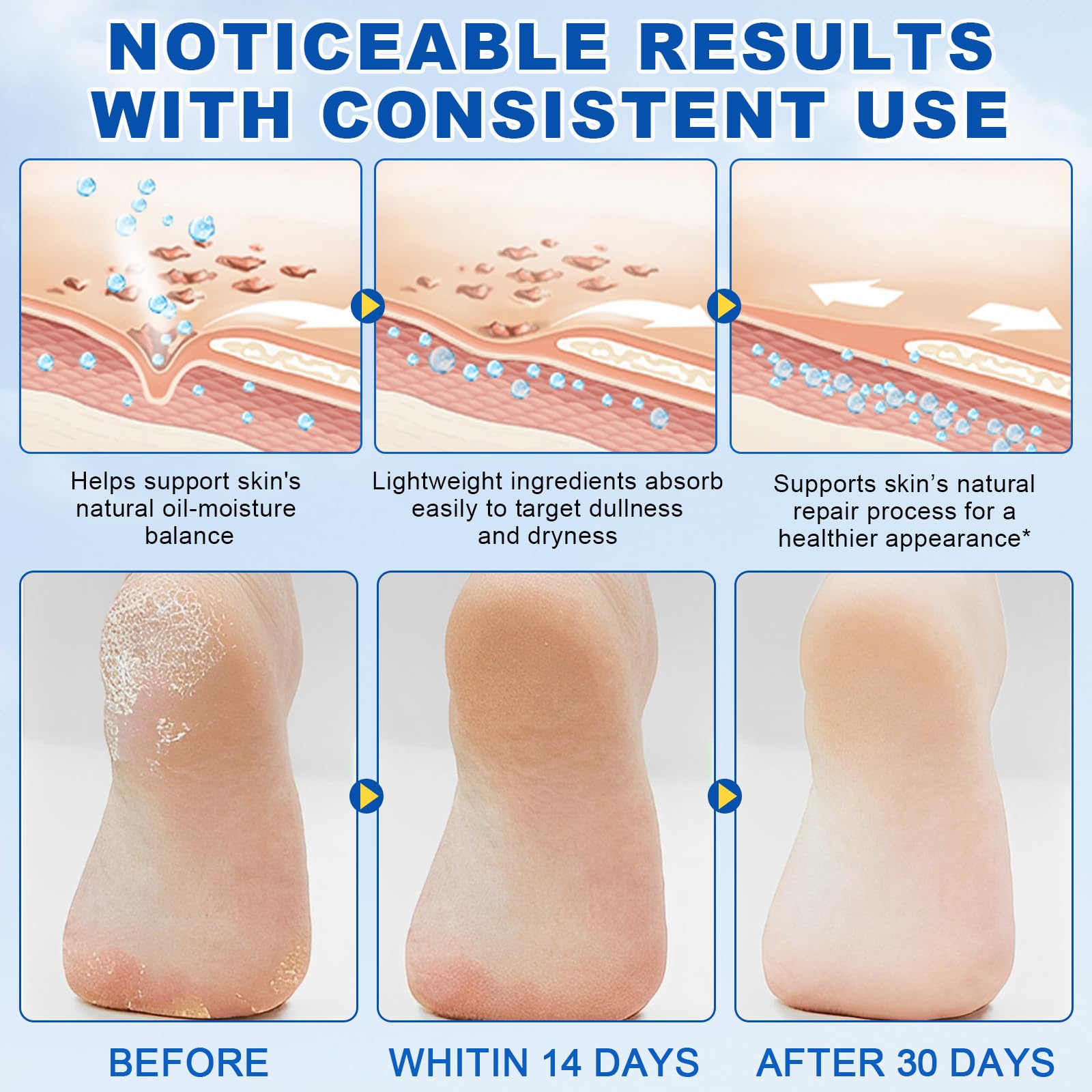 Urea foot cream smoothing image showing improved skin texture