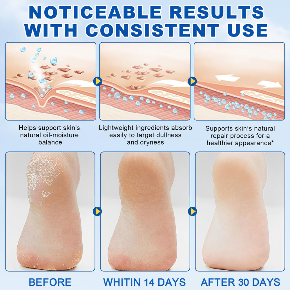 Urea foot cream smoothing image showing improved skin texture