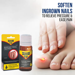 URIEL UPGRADED ingrown toenail-kit packaging showcases a complete home-care solution