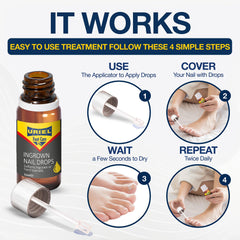 URIEL UPGRADED ingrown-toenail-tools-preview demonstrates safe at-home removal steps