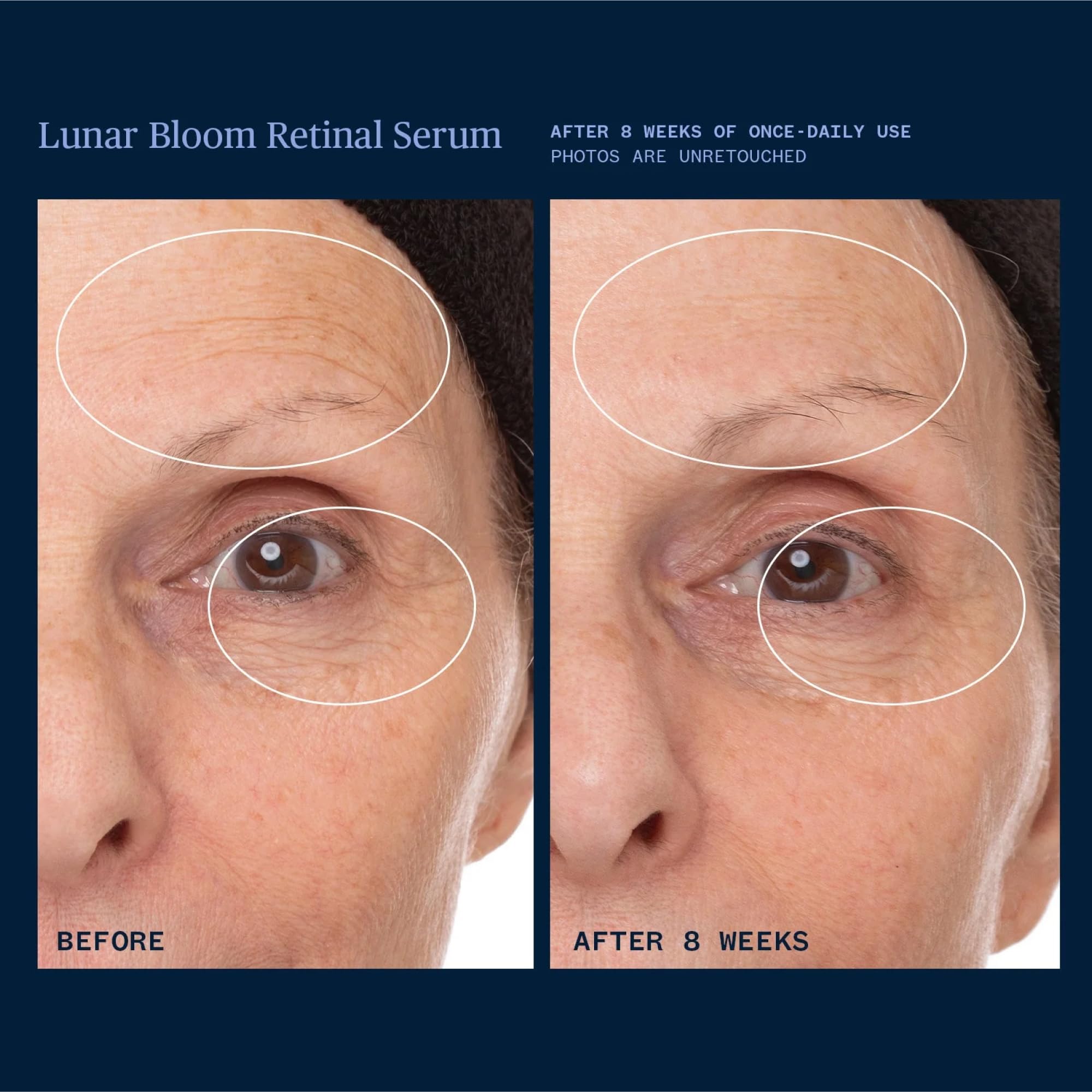 Ursa Major Lunar Bloom Retinal Serum packaging label details