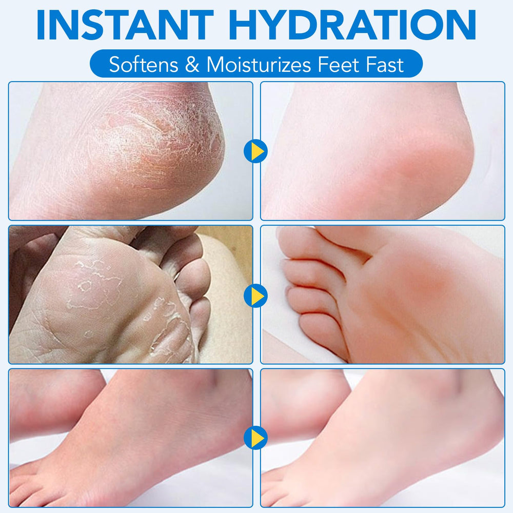 Uruses skin-moisture close-up illustrates hydrated, flexible skin after use.