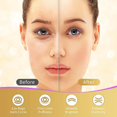 USTELIR Hyaluronic acid under-eye patches hydrate and plump the eye area