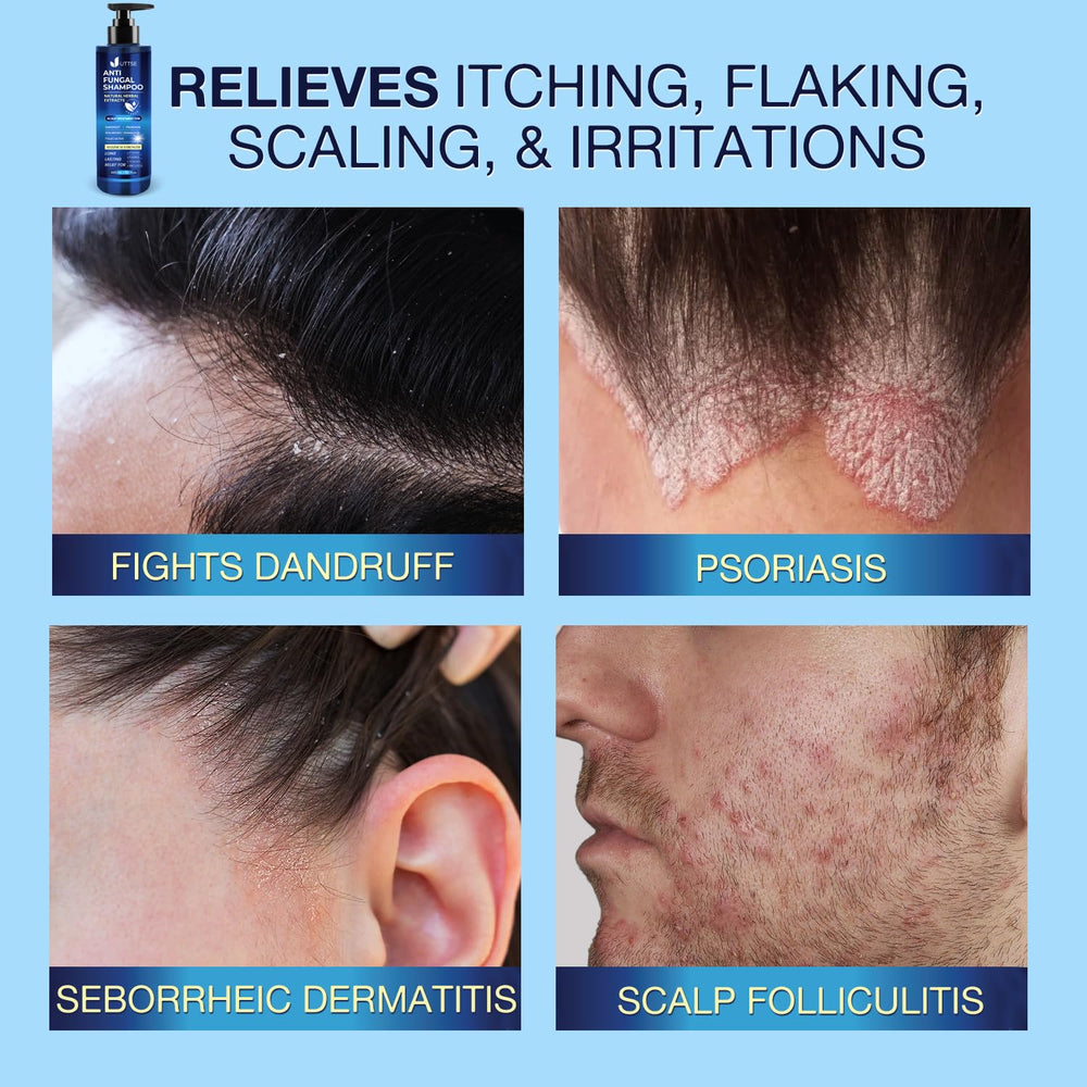 Uttse anti-fungal shampoo label highlights active ingredients for gentle cleansing and scalp soothing.