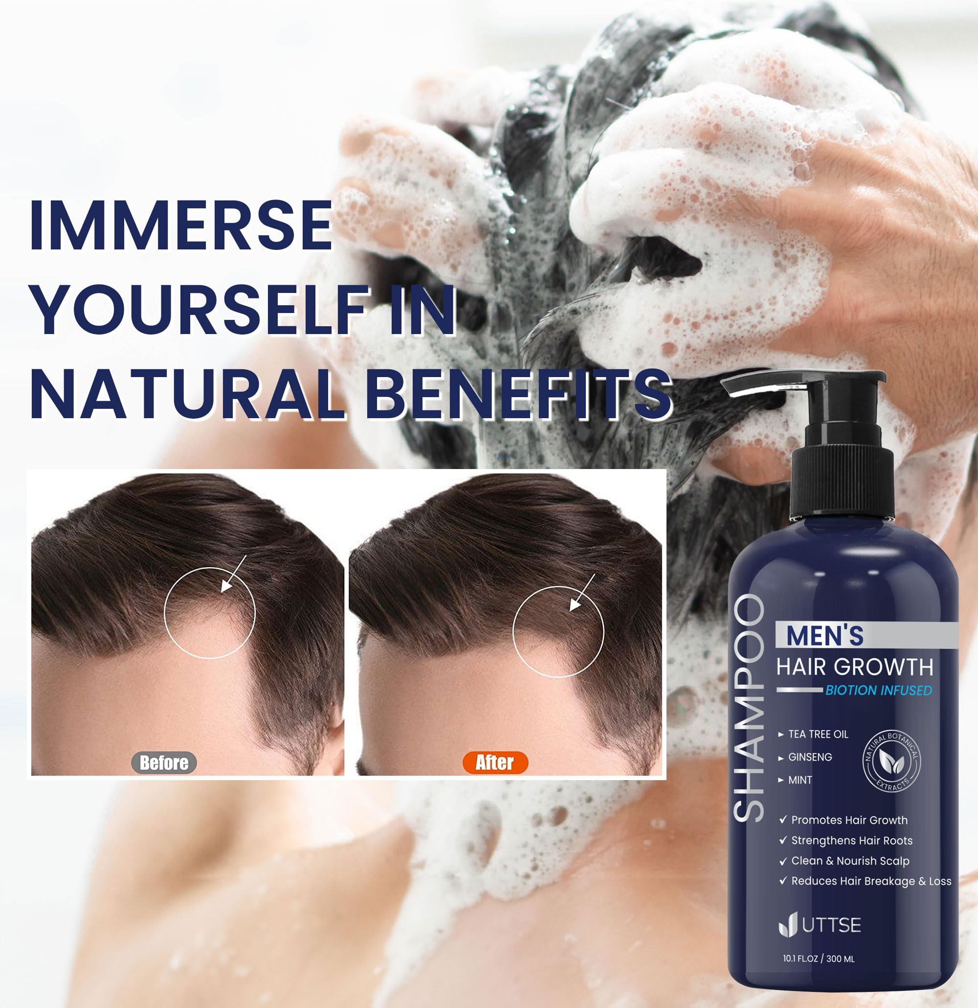 Uttse Biotion shampoo tea-tree oil ingredient—refreshing cleanse with antimicrobial notes.