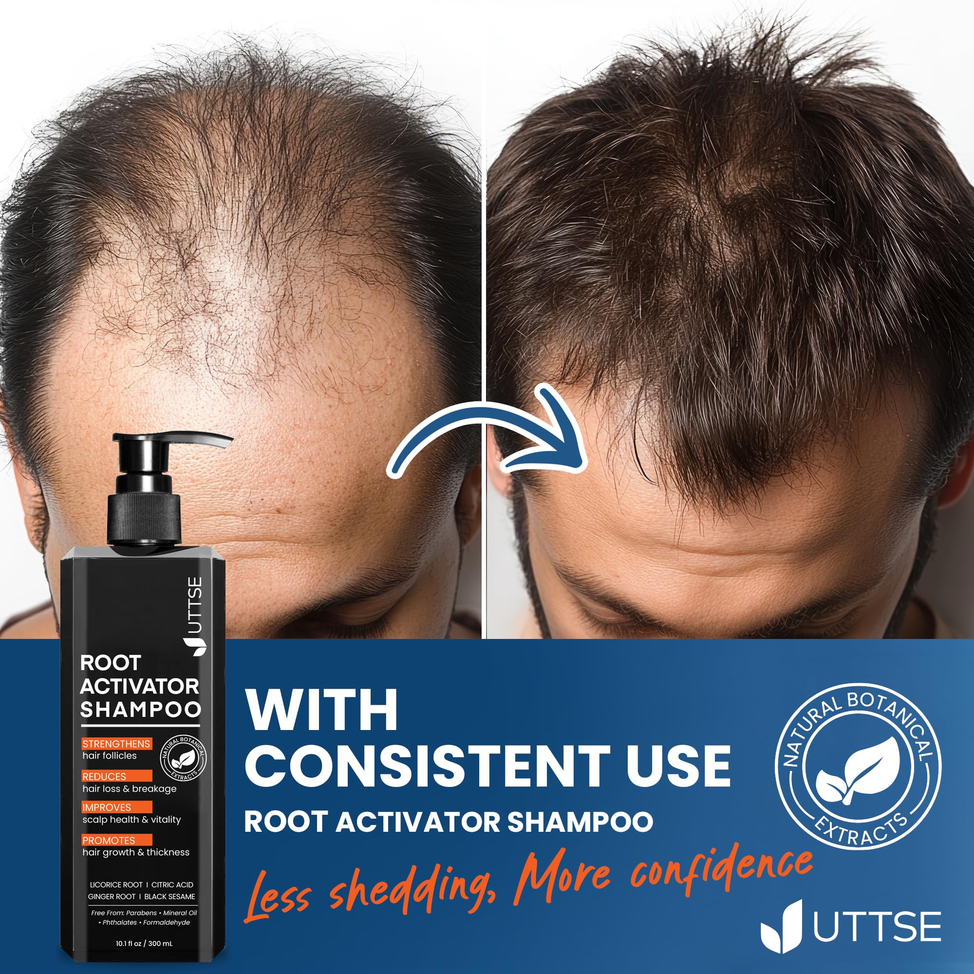 Uttse Root Activator Shampoo packaging highlights hair growth support through plant extracts.